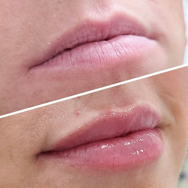 avant après avoir utilisé l'huile à lèvres ARTIST